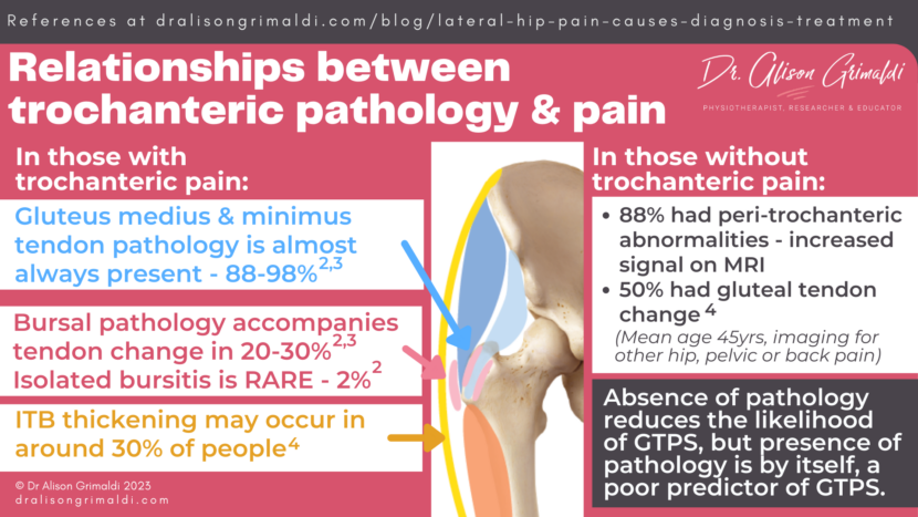 Lateral Hip Pain Causes Diagnosis And Treatment Find Out More