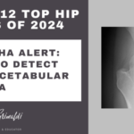 10-of-12-top-hip-papers-of-2024-the-alpha-alert-an-aid-to-detect-adult-acetabular-dyplasia