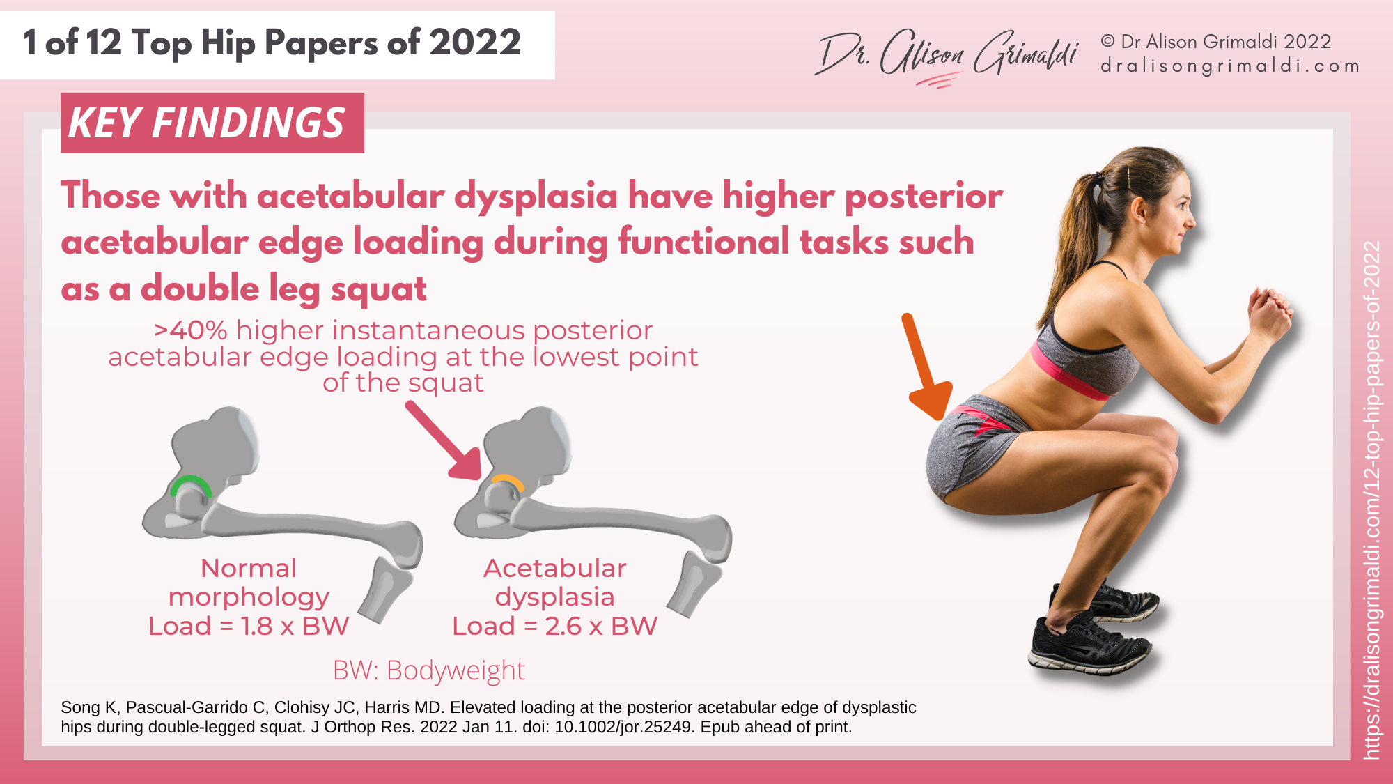 Key Findings - 1 of 12 - acetabular dysplasia, exercise