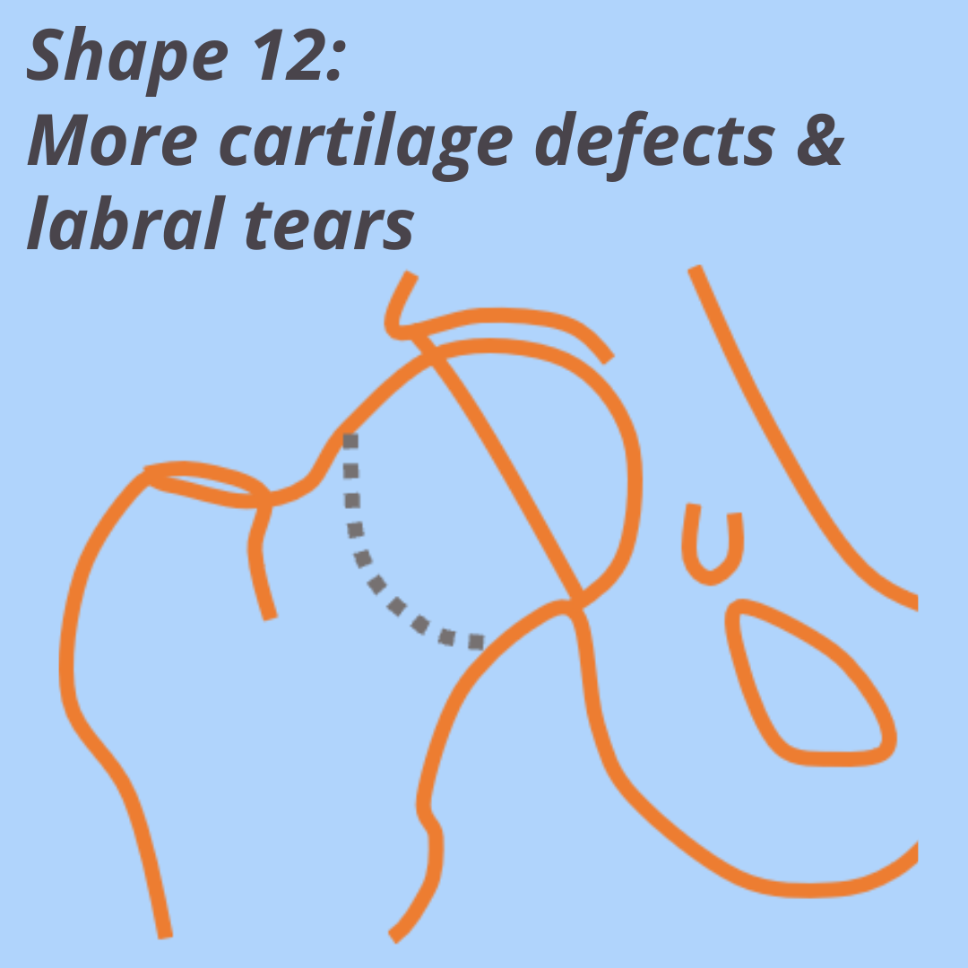 Shape 12: More cartilage defects & labral tears