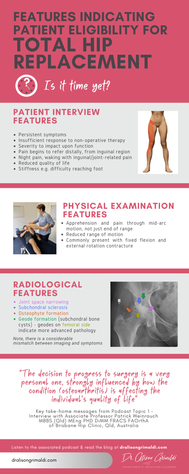 Total Hip Replacement - Is it time yet? | Dr Alison Grimaldi