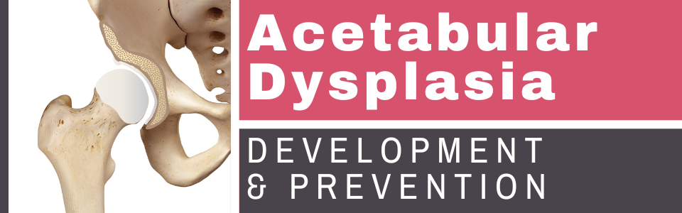 Acetabular Dysplasia: Development, Impact, Prevention