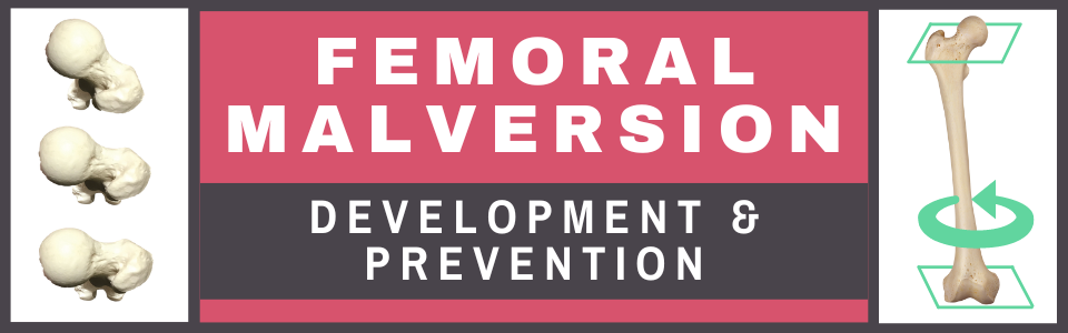 Femoral Malversion - Development & Prevention