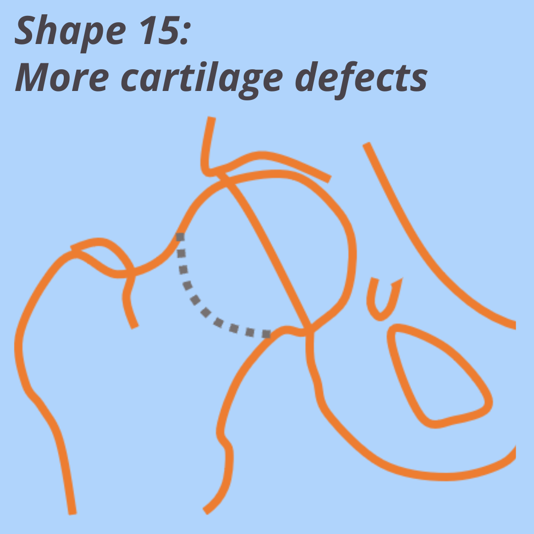 Shape 15: More cartilage defects