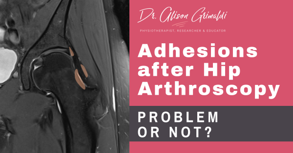 adhesions-after-hip-arthroscopy-prevention-&-treatment