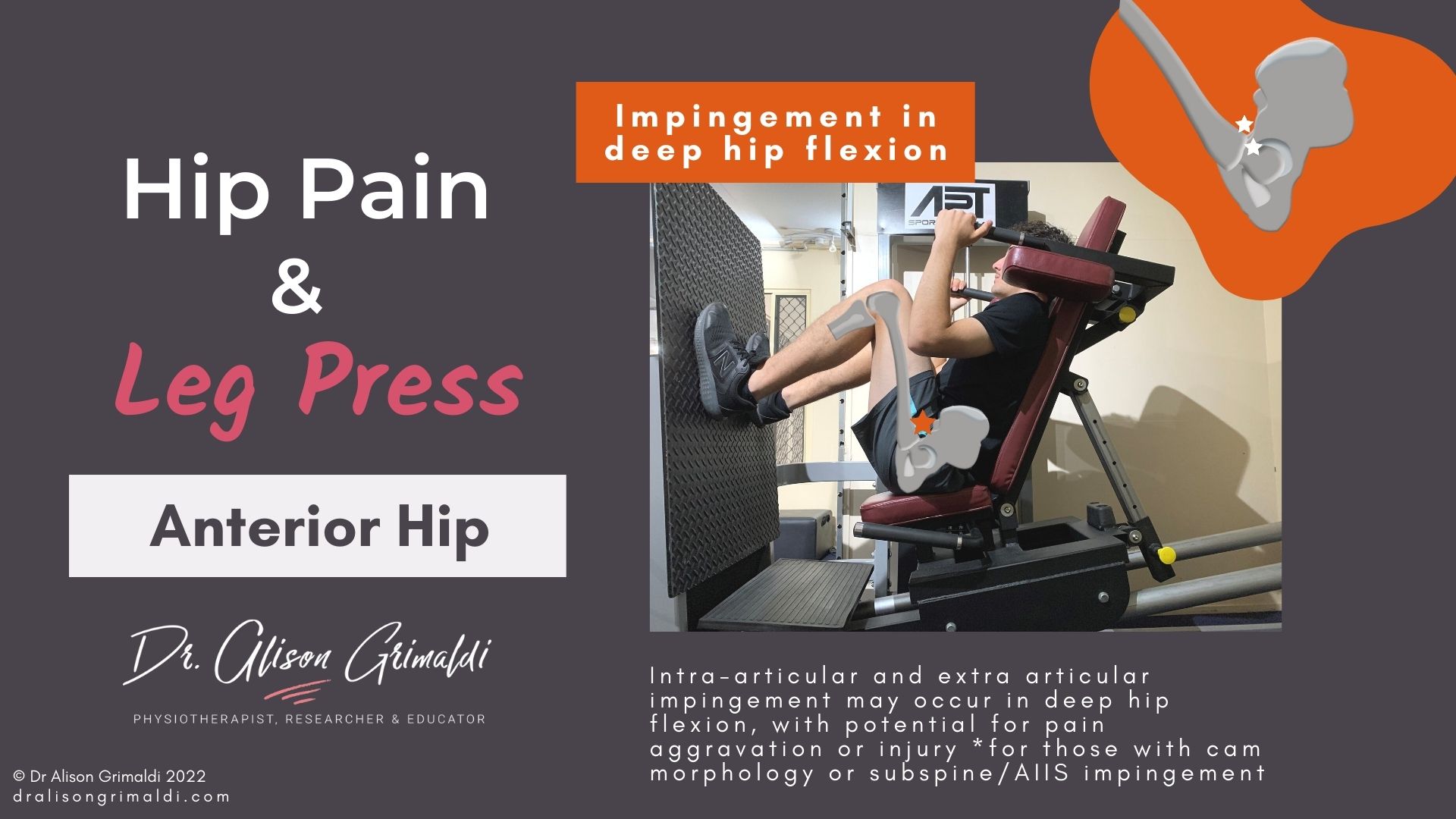 Anterior hip pain and leg press - in the dralisongrimaldi_blog