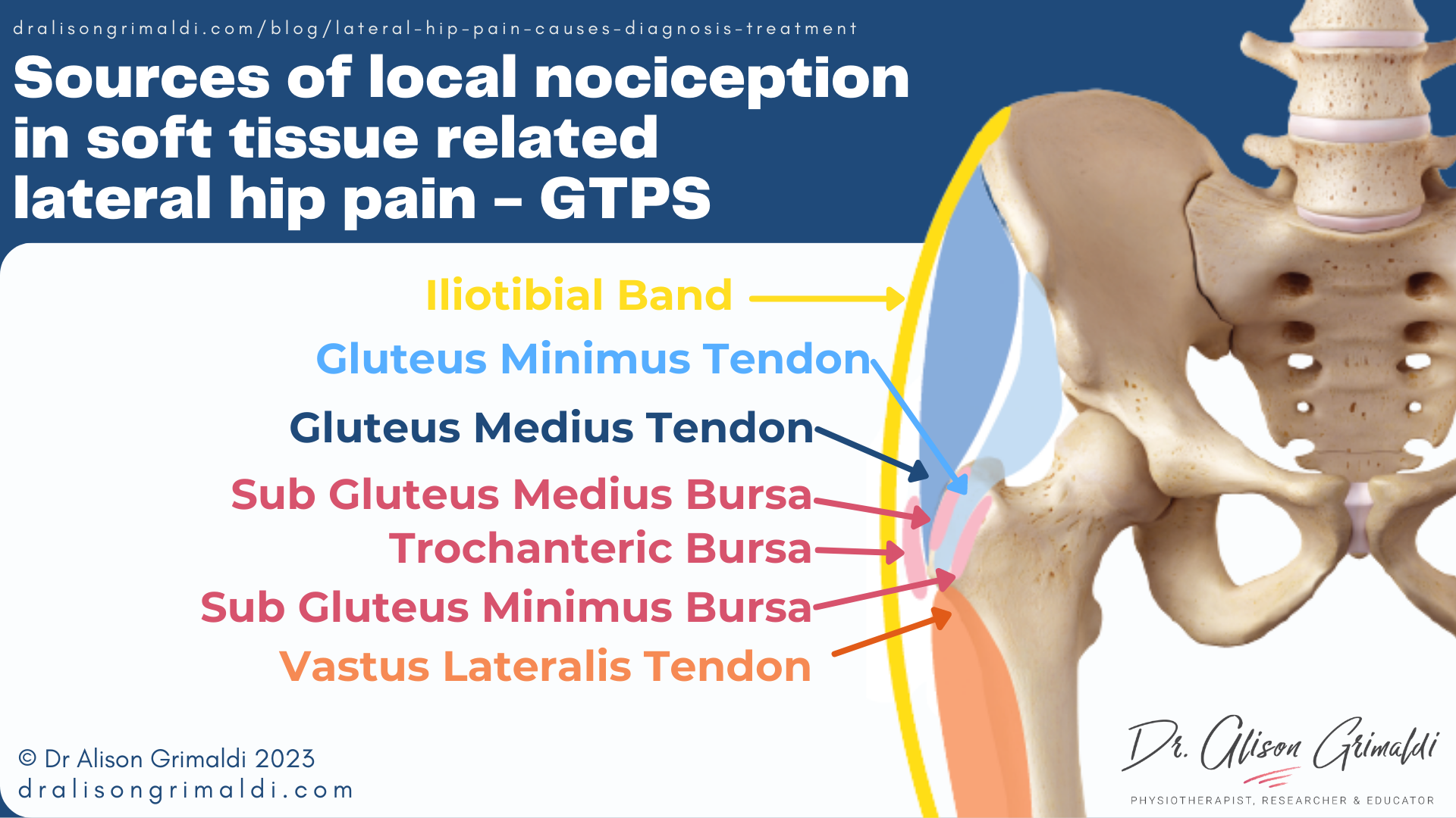 Sources-of-local-nociception-in-soft-tissue-related-lateral-hip-pain-GTPS