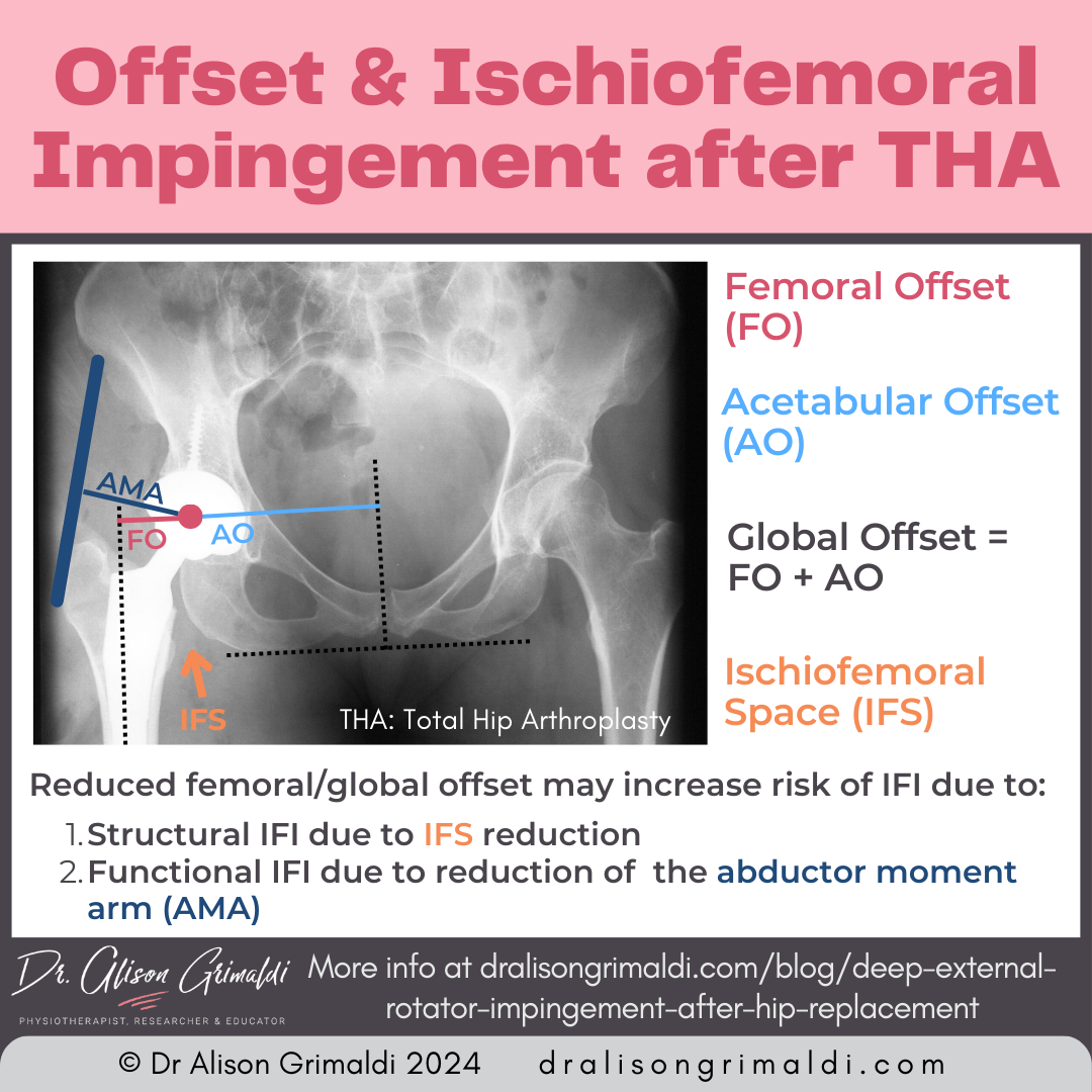 offset-&-ischiofemoral-impingement-after-THA