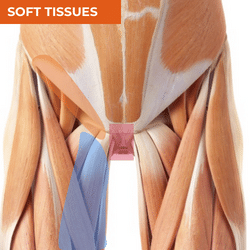 Differential Diagnosis of Groin Pain_Soft Tissues