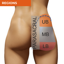 Differential Diagnosis of Hip Pain_Regions of the Buttock