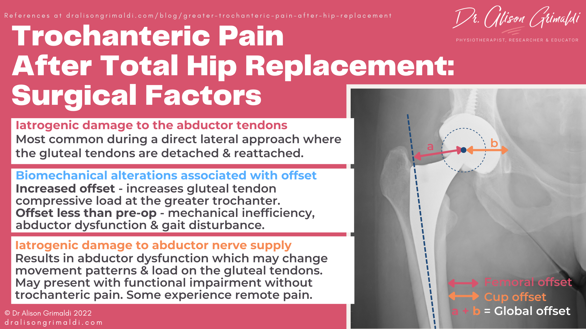 Trochanteric Pain After Total Hip Replacement: Surgical Factors