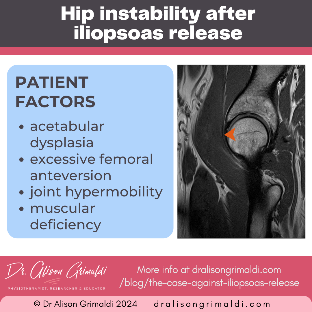 patient-factors-of-hip-instability-after-iliopsoas-release
