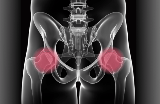 Hip Pain Management Courses Online Online Hip Pain Management Courses