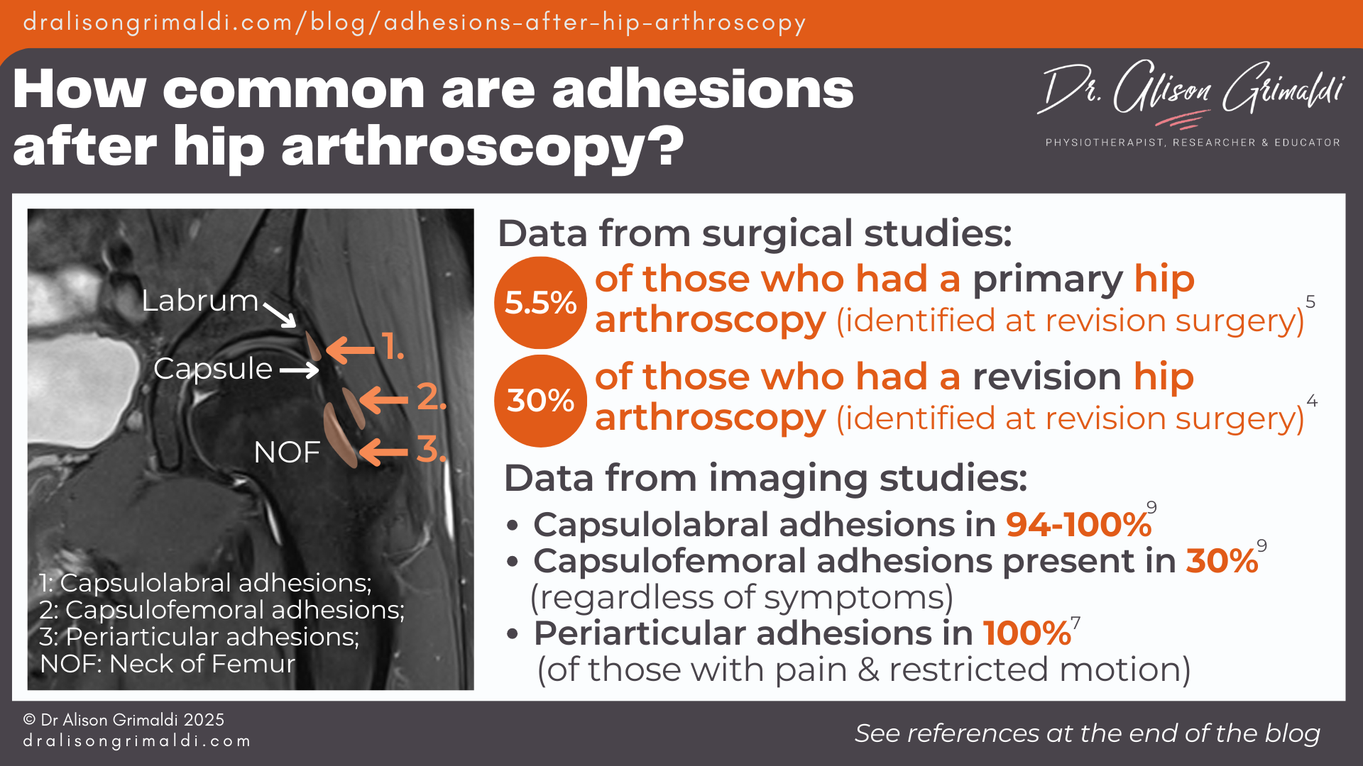How-common-are-adhesions-after-hip-arthroscopy