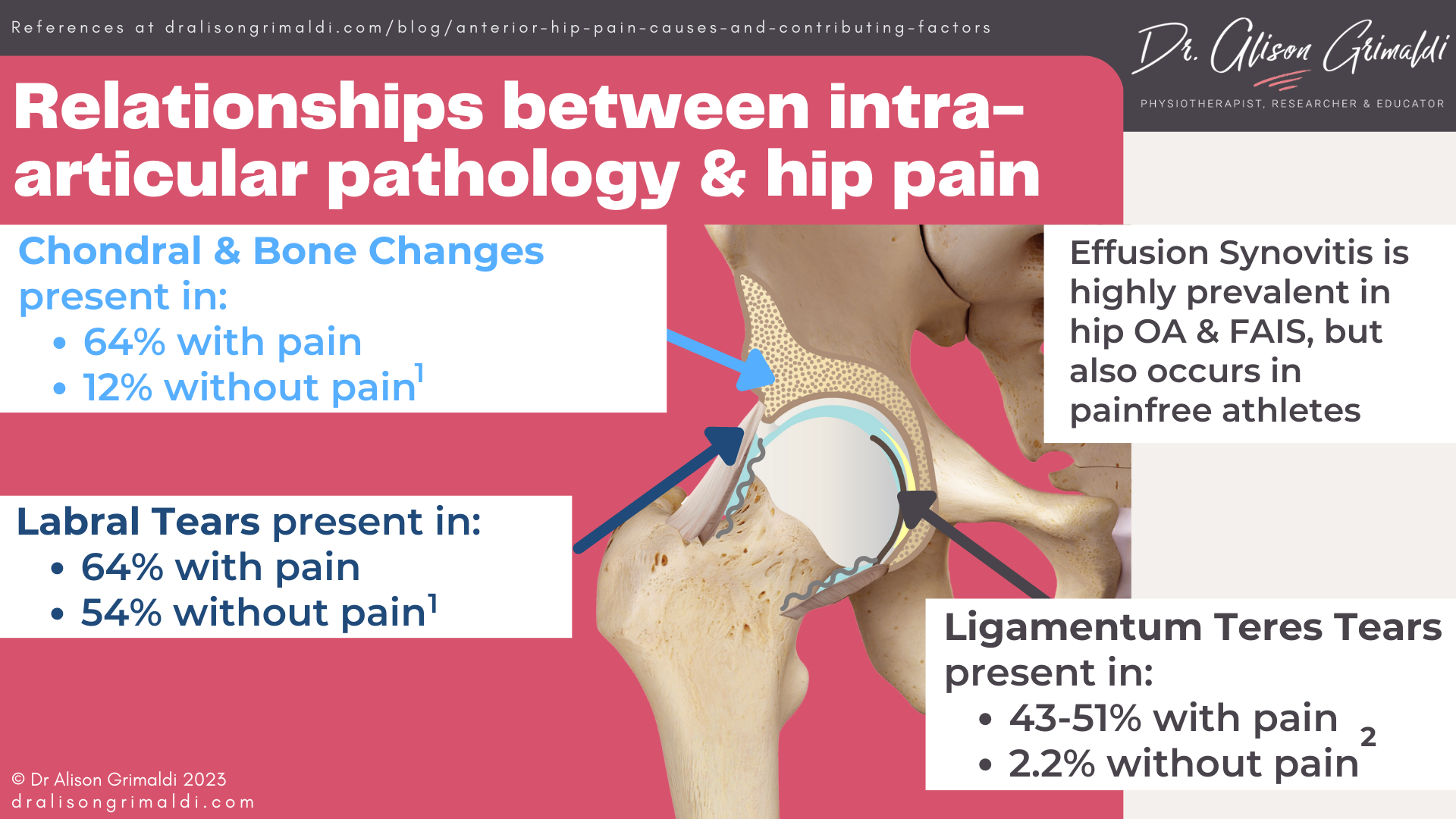Relationships-between-intra-articular-pathology-&-hip-pain