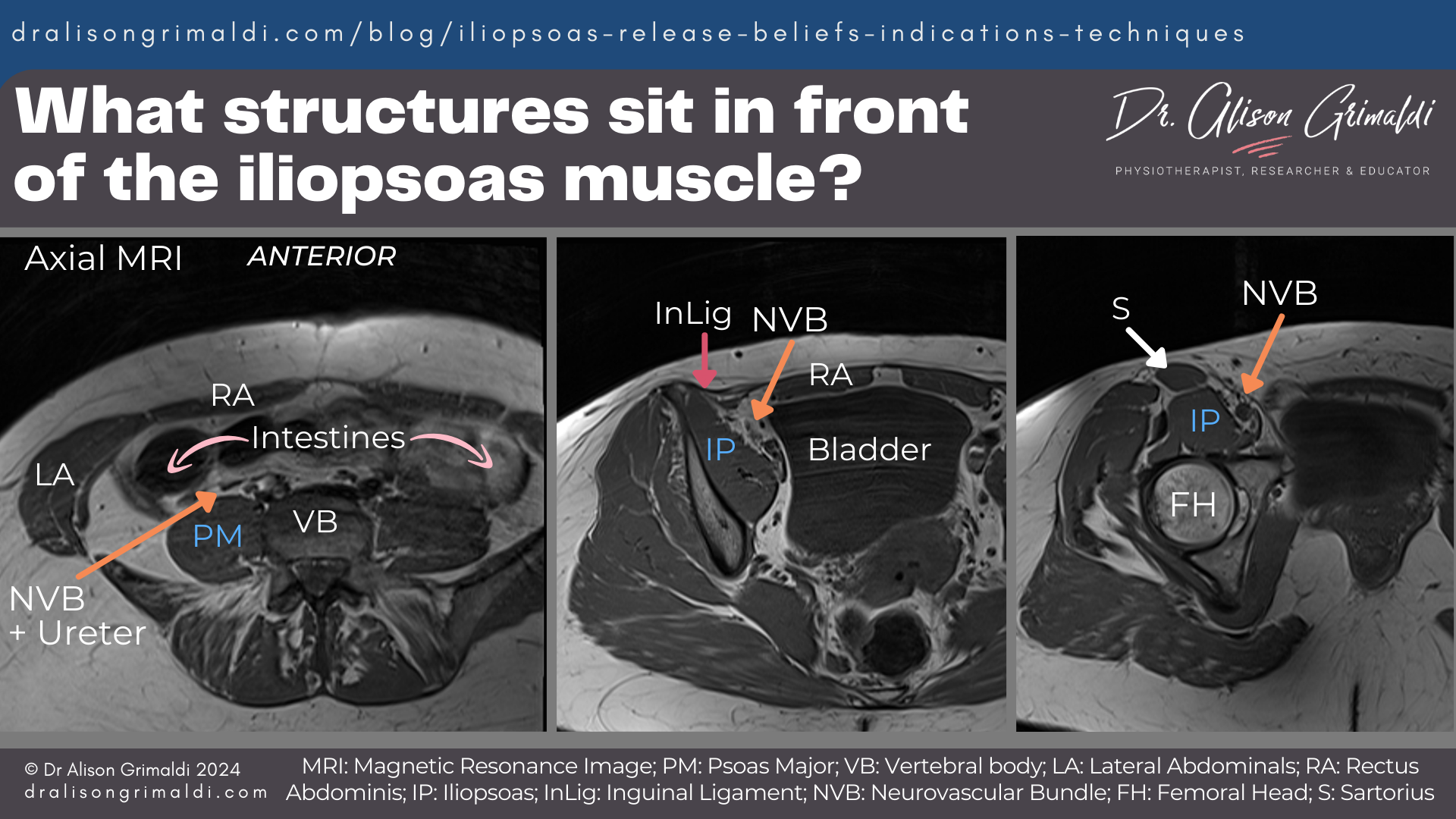 What-structures-sit in-front-of-the-iliopsoas-muscle