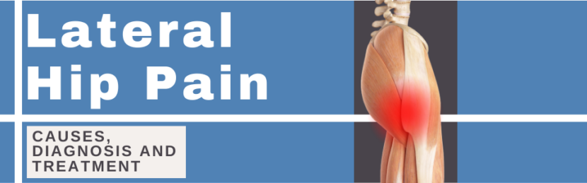 Lateral Hip Pain: Causes, diagnosis and treatment | Find out more