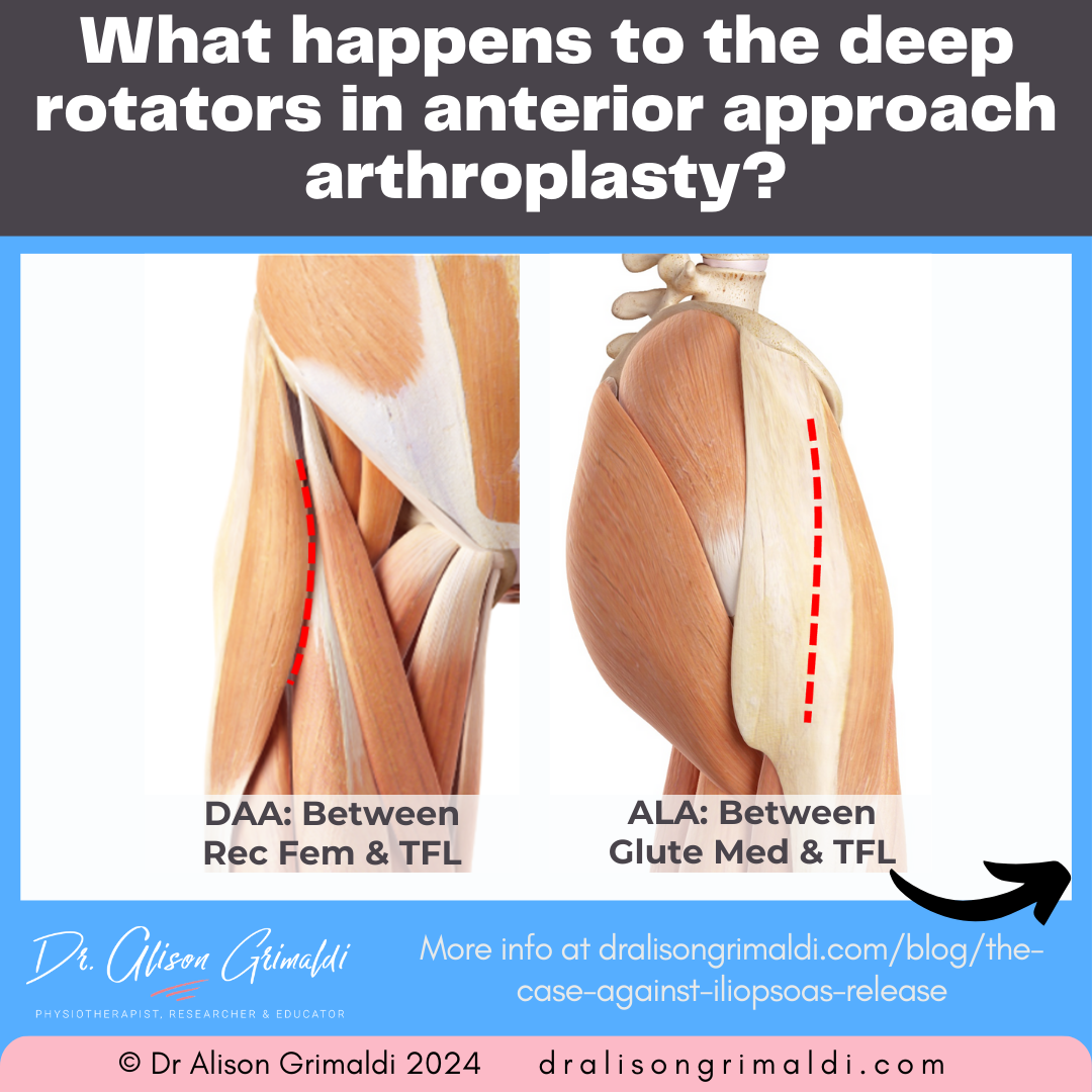 what-happens-to-the-deep-rotators-in-anterior-approach-arthroplasty