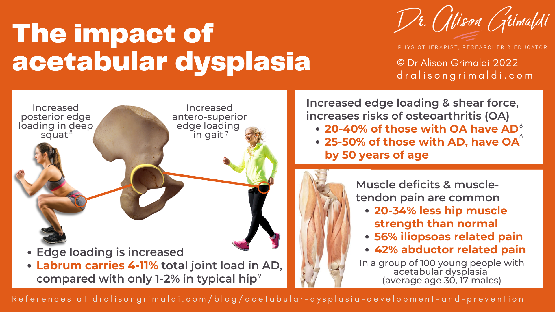 The impact of acetabular dysplasia