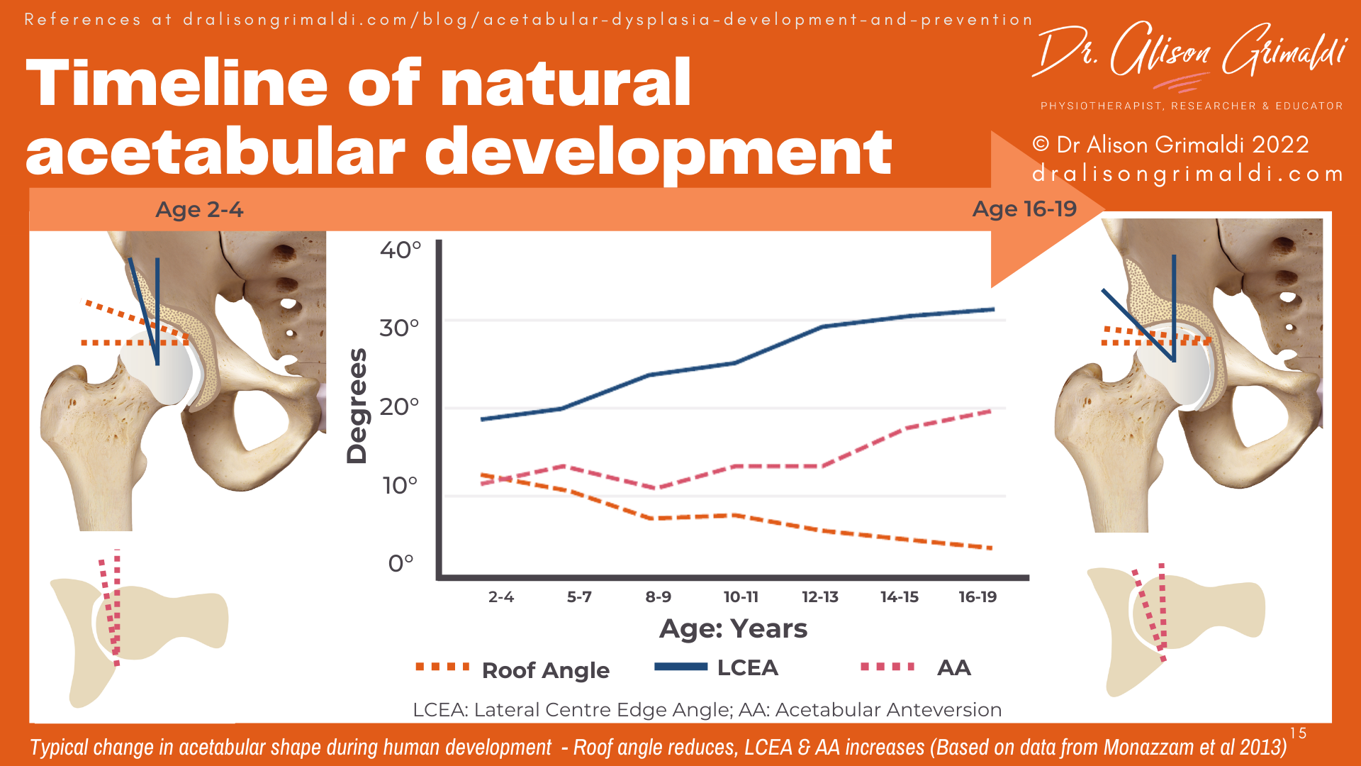 Timeline of natural acetabular development