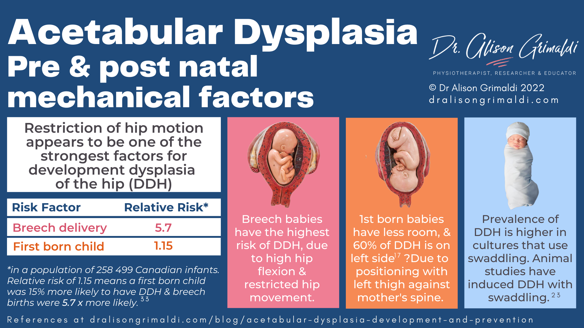 Acetabular Dysplasia Pre & post natal mechanical factors