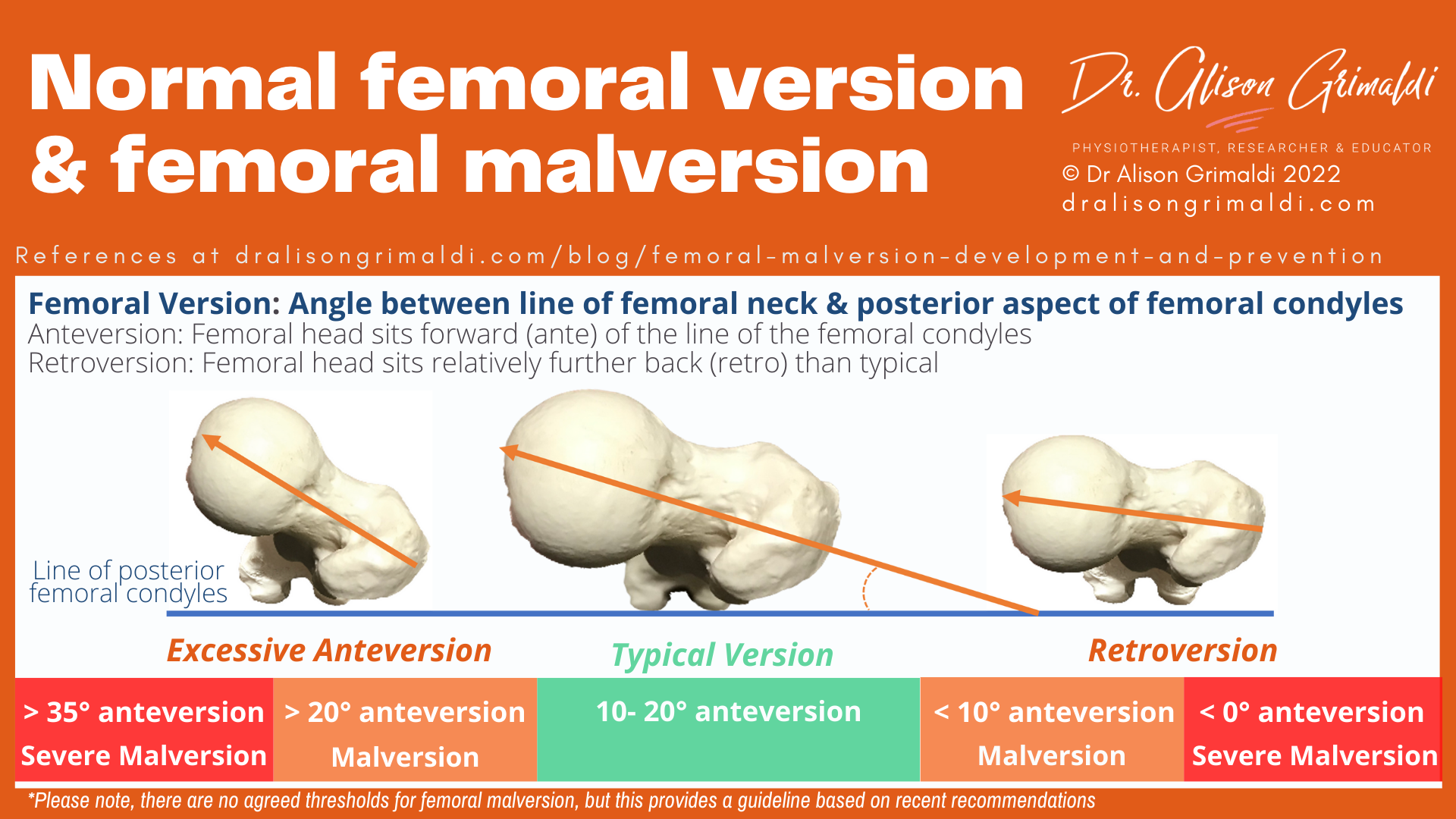 Normal femoral version & femoral malversion