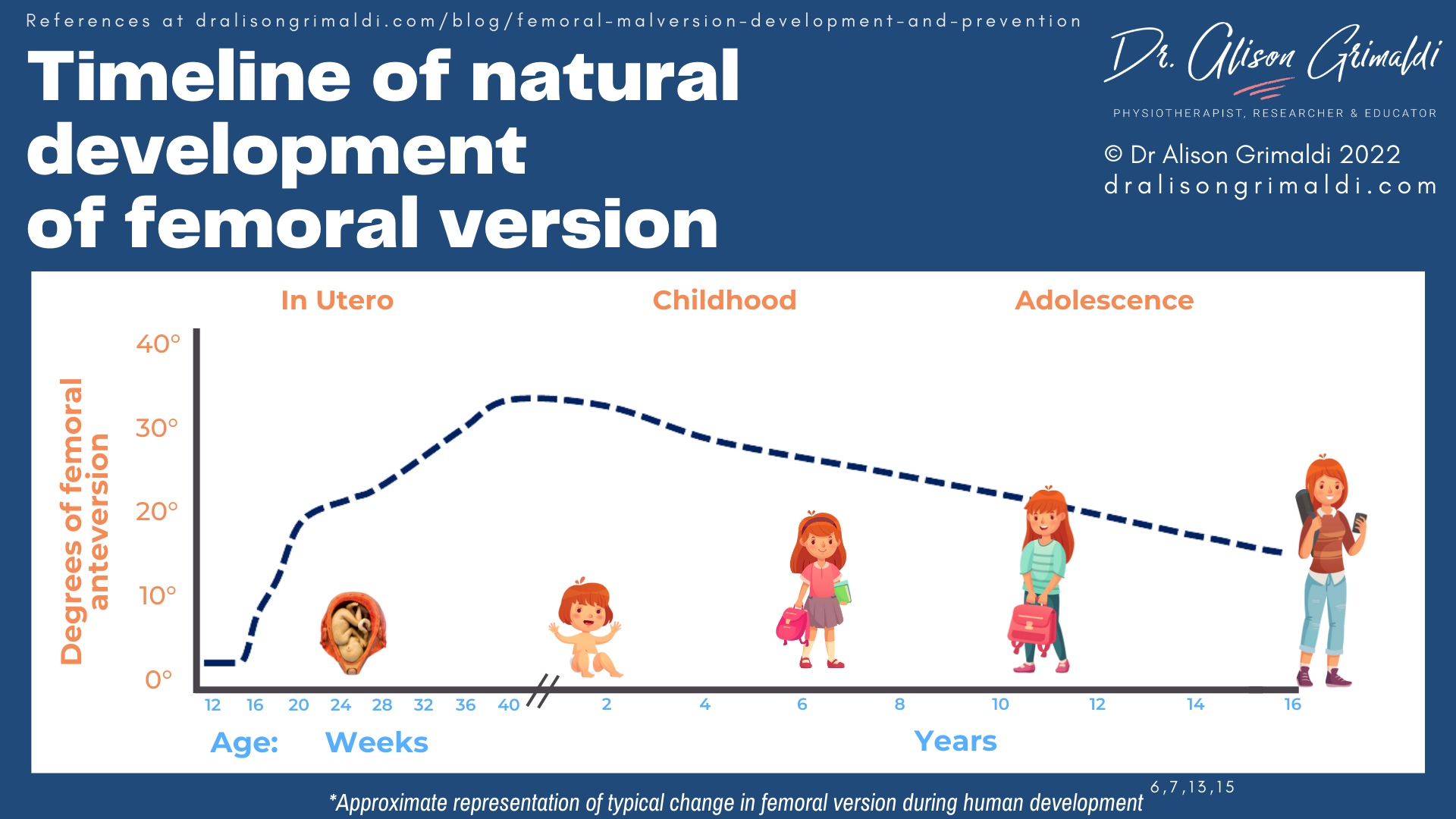 Timeline of natural development of femoral version