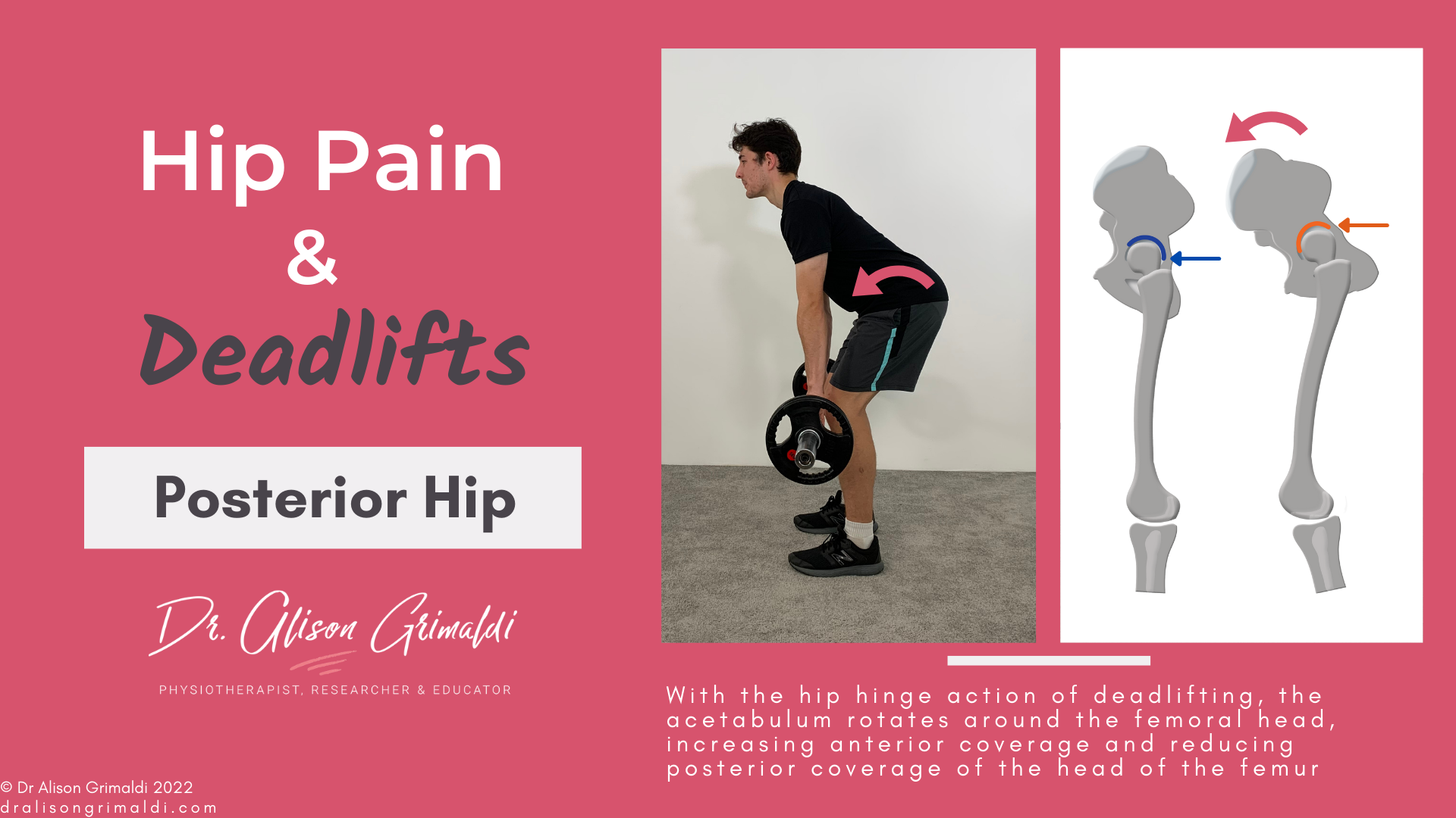 Posterior hip pain and deadlifts_dralisongrimaldi_blog