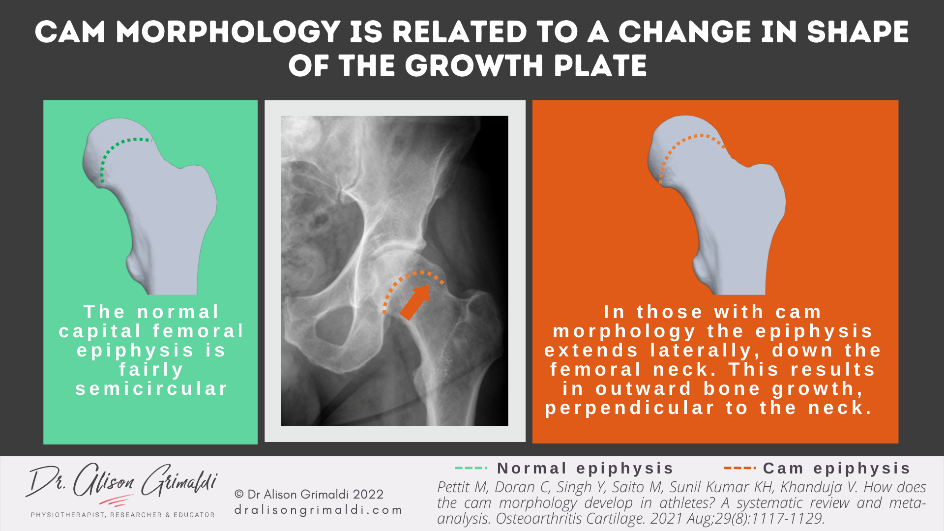 CHANGE IN GROWTH PLATE SHAPE