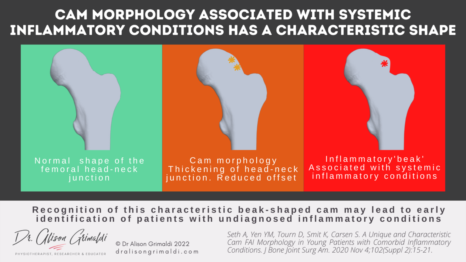 Cam Morphology Development and Prevention Find out more