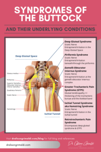 How many syndromes can a buttock have? | Dr Alison Grimaldi