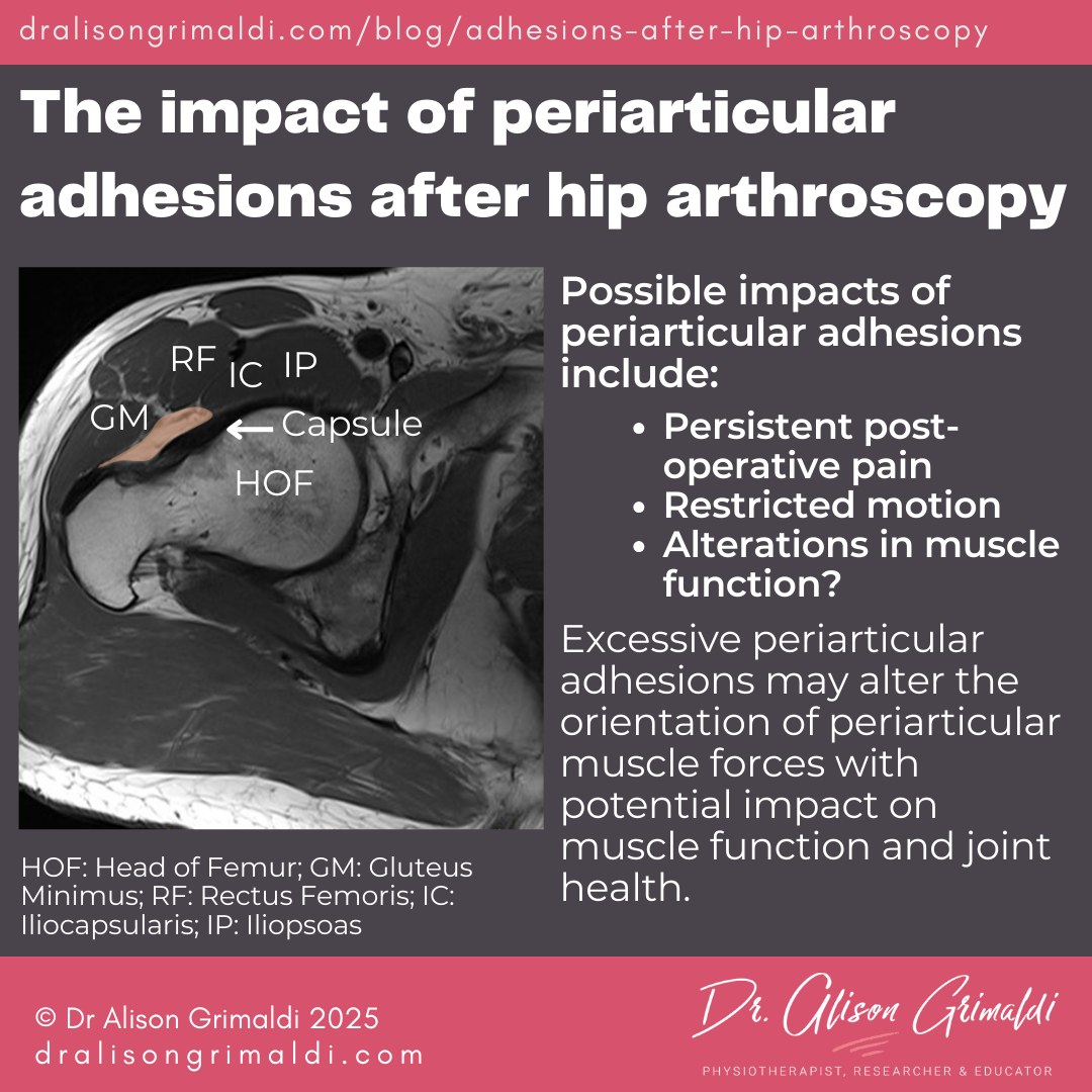 The-impact-of-periarticular-adhesions-after-hip-arthroscopy