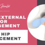 deep-external-rotator-impingement-after-hip-replacement