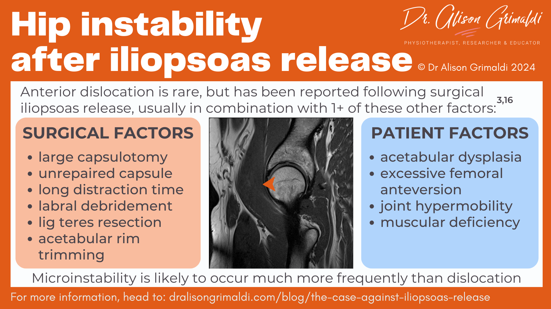 hip-instability-after-iliopsoas-release