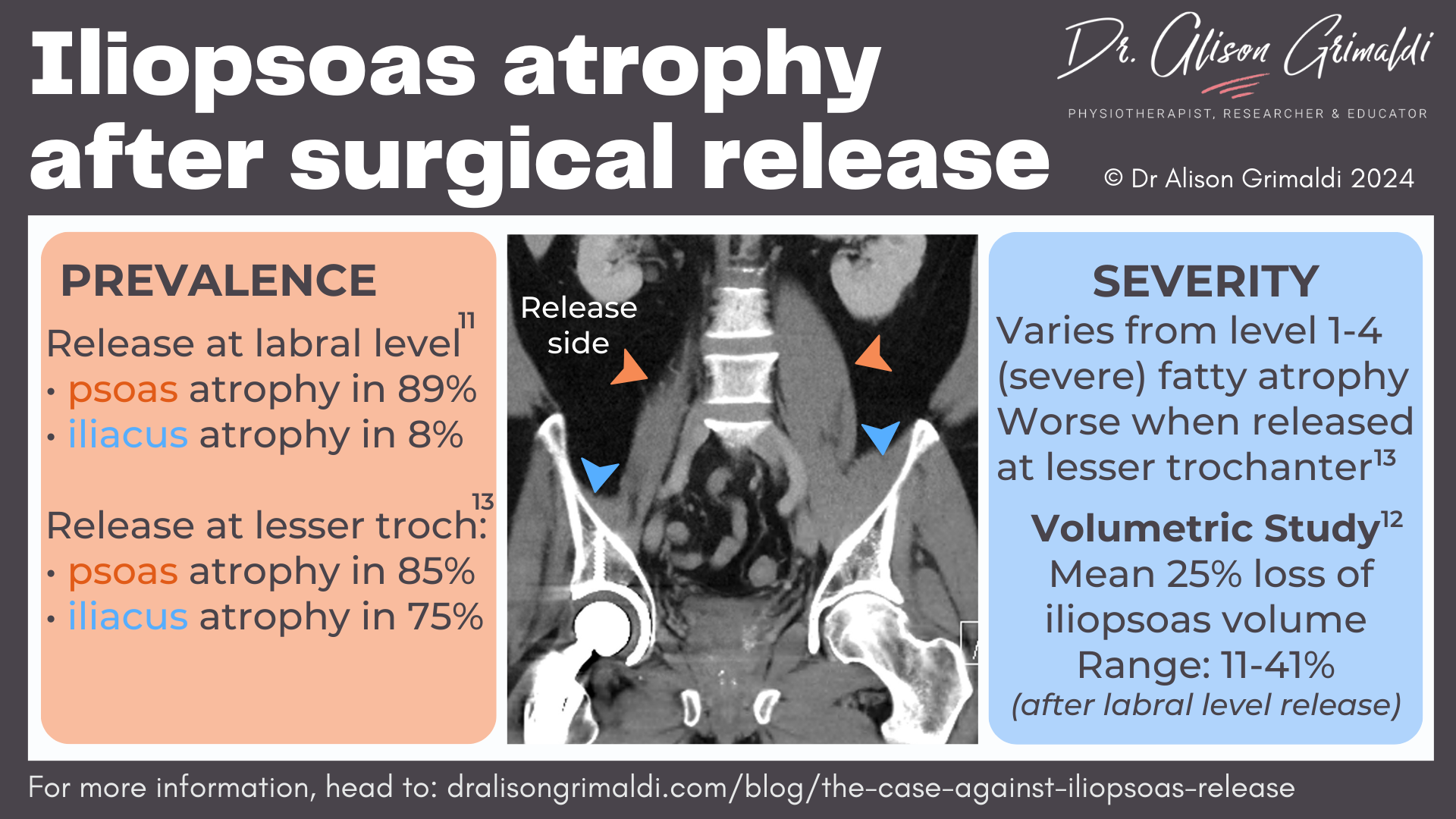 iliopsoas-atrophy-after-surgical-release