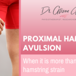 proximal-hamstring-avulsion-when-it-is-more-than-a-hamstring-strain